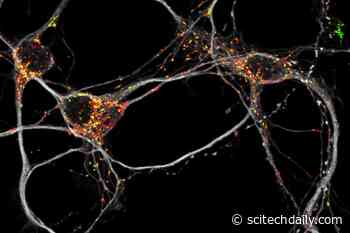 Metabolic Rewiring: Nerve Cells With Energy Saving Program