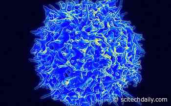 IBD Linked to an Immune Cell Run Amok – Helps Explain Why Autoimmune Diseases Are Often Chronic