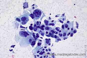 MET Inhibitors Active in Advanced NSCLC