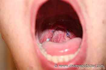 Trial: Oral Surgery Helps in Sleep Apnea
