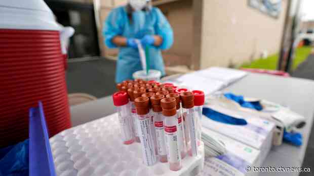 Ontario records highest number of daily COVID-19 cases since July