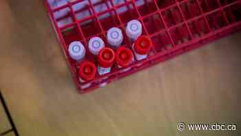 COVID-19 in Sask: 11 new cases, one new recovery announced Monday