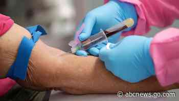 Bold hopes for virus antibody tests still unfulfilled