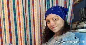 Burns survivor proud of scars after doctors didn't think she'd survive tragedy