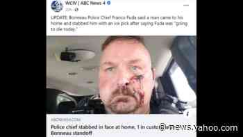 Police chief stabbed in face with ice pick after answering his door, SC cops say