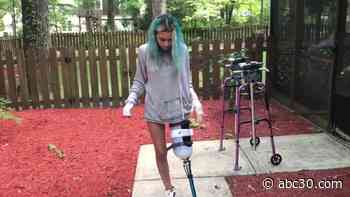 'Everybody's normal is different': Paige Winter reflects on life after losing leg in shark attack