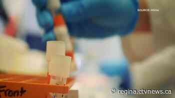 6 new COVID-19 cases in Sask.; 59 cases active