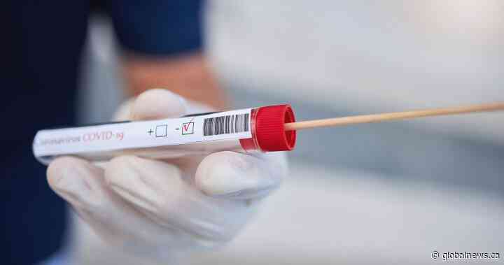 Possible coronavirus exposure at 2 Saskatoon stores - Global News