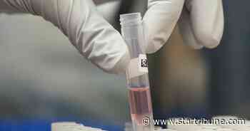 Broad COVID-19 testing under microscope