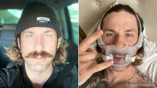 Months after infection, COVID-19 patients report breathing difficulty, excessive fatigue