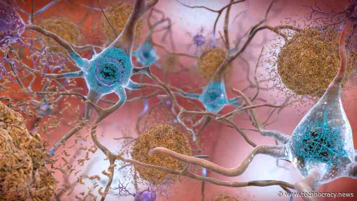 New Study Admits That COVID-19 Can Infect Brain Cells