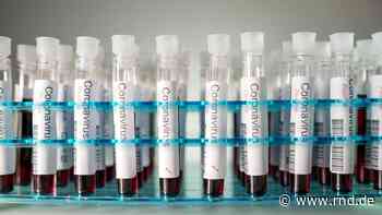 Chinesische Virologin: Coronavirus stammt aus Labor in Wuhan - RND