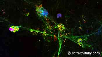 Sticky Webs of DNA Released From Immune Cells May Drive Lung Pathology in Severe COVID-19