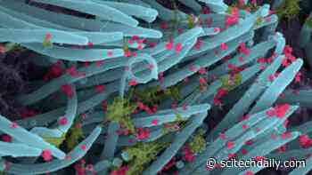 Startlingly New Images of SARS-CoV-2 Infected Cells – Ready to Spread COVID-19 Virus