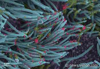 Photos of coronavirus attacking lung cells show how ‘intense’ infections can get