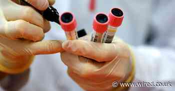 How CRISPR is helping scientists create a better coronavirus test