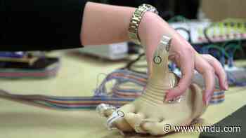 Medical Moment: The next generation of artificial limbs - WNDU
