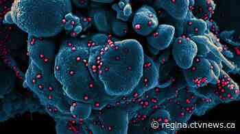 10 new coronavirus cases reported in Sask.; 107 now active