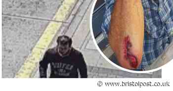 Pensioner needed surgery after being pushed to the ground
