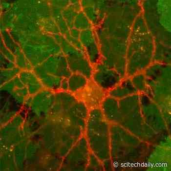 Unlocking the Mysteries of Brain Chemistry With New Dopamine Sensors