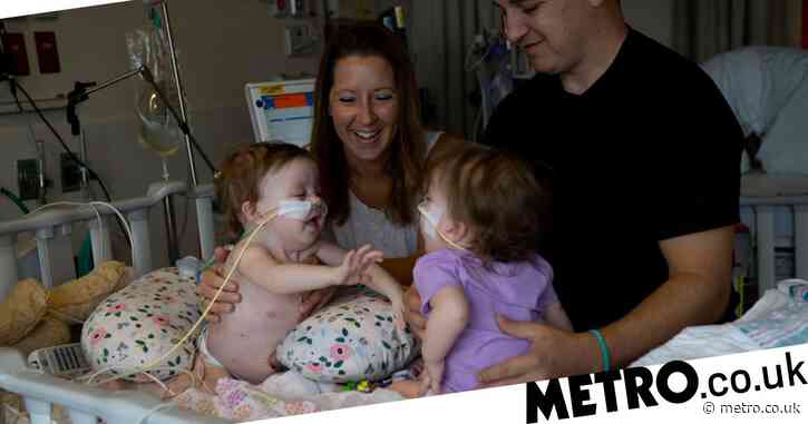 One-year-old conjoined twins successfully separated in 11-hour surgery