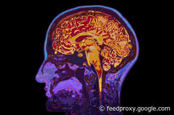 Has The Stress of COVID Affected Our Brains?