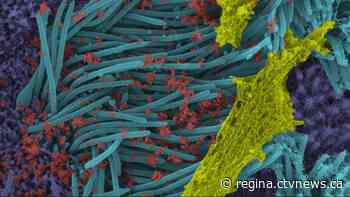 Sask. reports 11 new coronavirus cases; record high daily testing