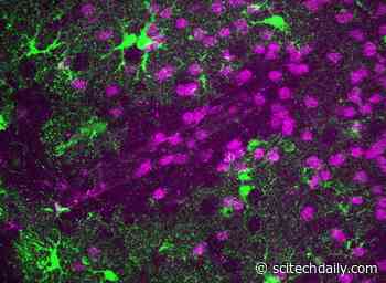 Improved Understanding of Blood-Brain Barrier Health Has Implications for a Variety of Neurological Diseases