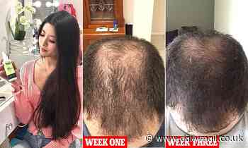 Entrepreneur, 34, expected to make $5MILLION this year selling a unique hair growth spray - Daily Mail
