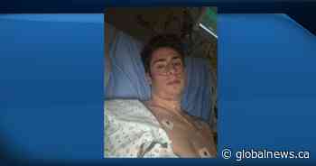 Calgary man recounts slow recovery from COVID-19, worries about long-term health impacts