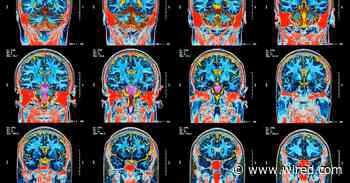 Lawmakers Demand Scrutiny of Racial Bias in Health Algorithms