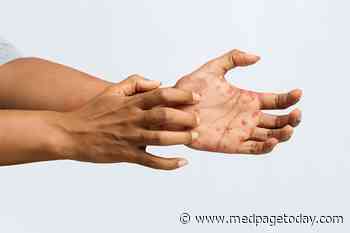 Dermatology Reckoning With Long-Standing Racial Inequities