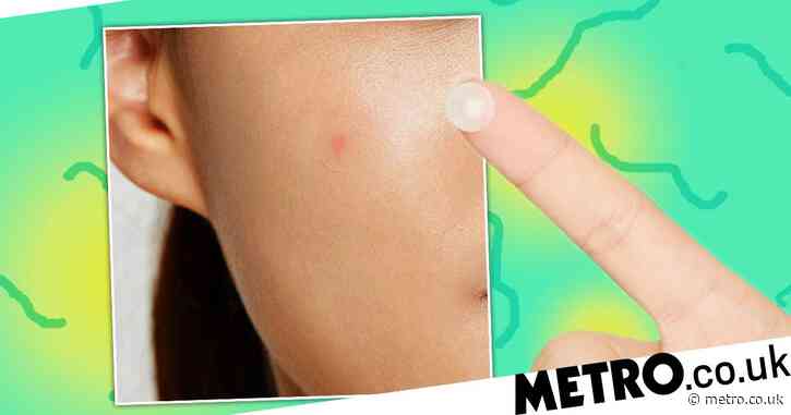 Are the COSRX Acne Master Pimple Patch spot dots worth the faff?