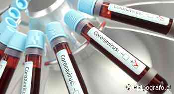 O'Higgins supera los 16 mil casos de coronavirus - Diario El Tipógrafo