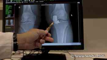 Medical Moment: Partial knee replacements - WNDU