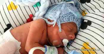 Tiny baby born 3 months premature weighing less than 3lbs makes miracle recovery