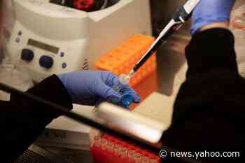 Positive COVID-19 test rates top 25% in some U.S. Midwest states