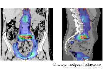 Studies Back Salvage RT After Prostatectomy