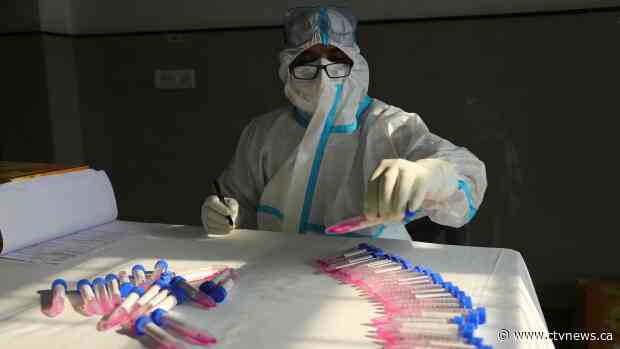 Big contact tracing study shows role of kids and superspreaders in COVID-19 pandemic