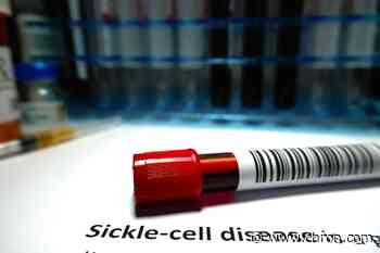 Approximately 40 percent of babies born with sickle cell disease in Texas are in Houston