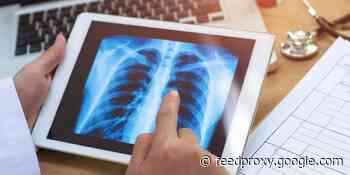 MIT CSAIL claims its AI system can predict and classify pulmonary edemas
