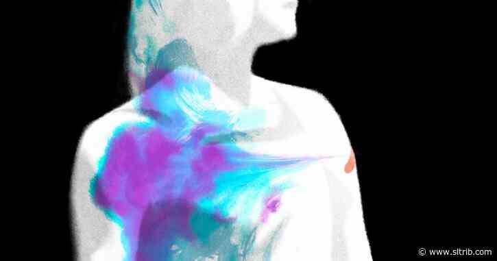 Molly Jong-Fast: Call me the Joan of Arc of coronavirus vaccine trials
