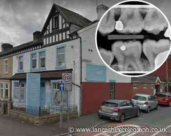 Tooth decay row leads to £3,000 pay-out for Blackburn man