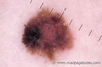 Five-Year OS Nears 40% in BRAF Wild Type Melanoma