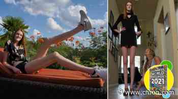 Texas teen breaks Guinness World Records for world's longest legs