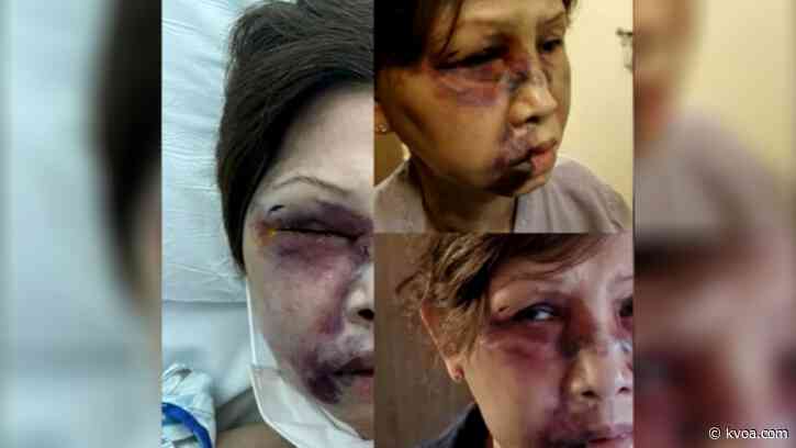 San Francisco sees two horrific attacks on elderly Asian woman