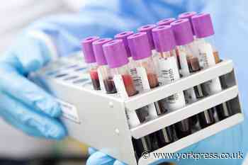 Routine blood tests in York cancelled due to NHS supply issue