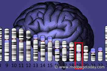 Another Alzheimer’s Target?