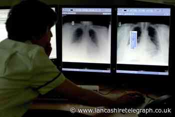 Over 70 tuberculosis cases recorded in Lancashire