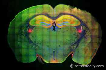 MIT Neuroscientists Discover a Molecular Mechanism That Allows Memories to Form